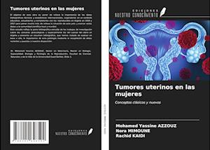 Tumores uterinos en las mujeres