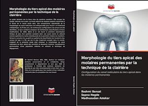 Morphologie du tiers apical des molaires permanentes par la technique de la clairière