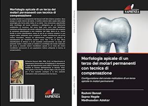 Morfologia apicale di un terzo dei molari permanenti con tecnica di compensazione