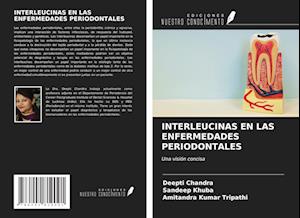 INTERLEUCINAS EN LAS ENFERMEDADES PERIODONTALES