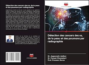 Détection des cancers des os, de la peau et des poumons par radiographie