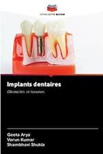 Implants dentaires