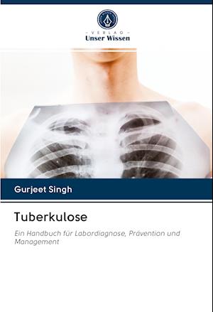 Tuberkulose