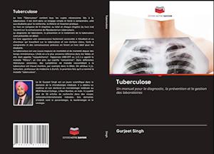 Tuberculose