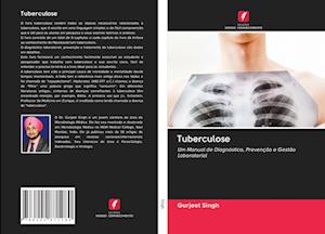 Tuberculose