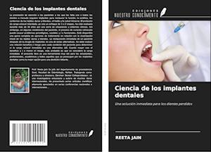 Ciencia de los implantes dentales