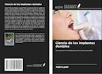 Ciencia de los implantes dentales