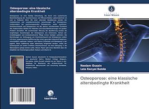 Osteoporose: eine klassische altersbedingte Krankheit