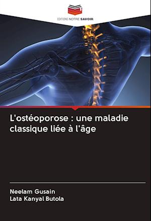 L'ostéoporose : une maladie classique liée à l'âge