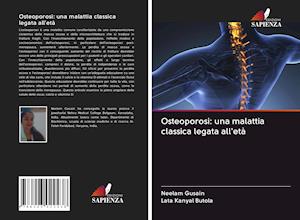 Osteoporosi: una malattia classica legata all'età