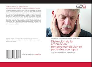 Disfunción de la articulación temporomandibular en pacientes con lupus