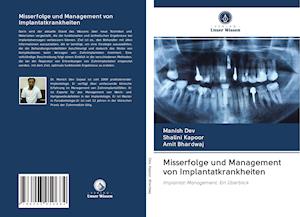 Misserfolge und Management von Implantatkrankheiten