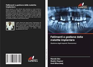 Fallimenti e gestione delle malattie implantare