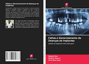 Falhas e Gerenciamento de Doenças de Implantes