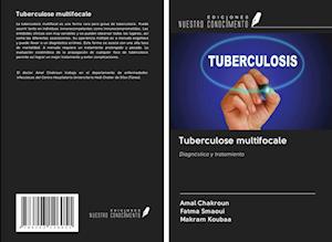 Tuberculose multifocale