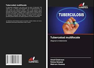 Tubercolosi multifocale