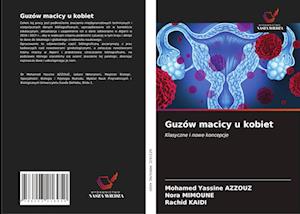 Guzów macicy u kobiet