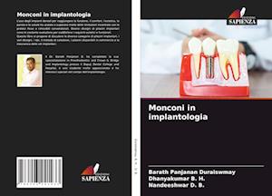 Monconi in implantologia