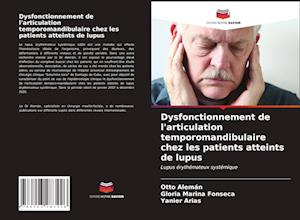 Dysfonctionnement de l'articulation temporomandibulaire chez les patients atteints de lupus