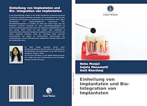 Einheilung von Implantaten und Bio- Integration von Implantaten