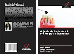 Gojenie sie implantów i biointegracja implantów