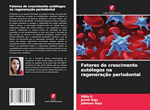 Fatores de crescimento autólogos na regeneração periodontal