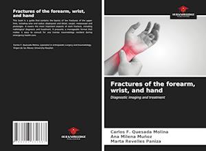 Fractures of the forearm, wrist, and hand