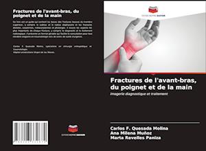 Fractures de l'avant-bras, du poignet et de la main