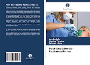 Post-Endodontie-Restaurationen