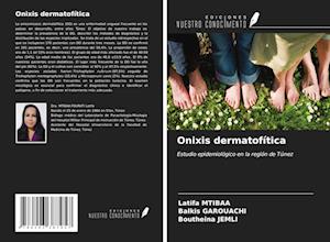 Onixis dermatofítica