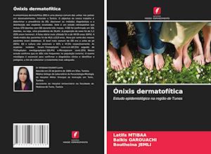 Ónixis dermatofítica