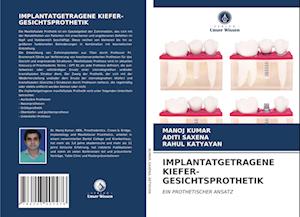 IMPLANTATGETRAGENE KIEFER-GESICHTSPROTHETIK