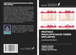 PRÓTESIS MAXILOFACIALES SOBRE IMPLANTES