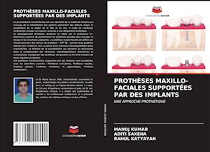 Prothèses Maxillo-Faciales Supportées Par Des Implants