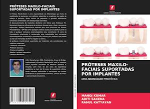 Próteses Maxilo-Faciais Suportadas Por Implantes