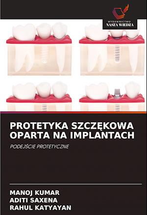 Protetyka Szcz&#280;kowa Oparta Na Implantach