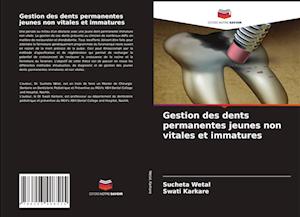 Gestion des dents permanentes jeunes non vitales et immatures