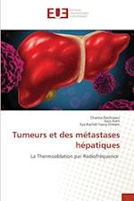 Tumeurs et des métastases hépatiques