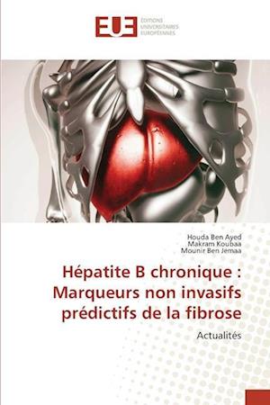 Hépatite B chronique : Marqueurs non invasifs prédictifs de la fibrose