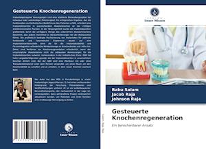 Gesteuerte Knochenregeneration