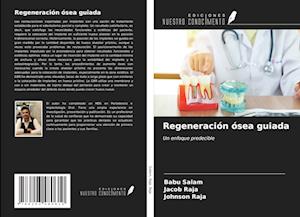 Regeneración ósea guiada