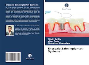 Enossale Zahnimplantat-Systeme