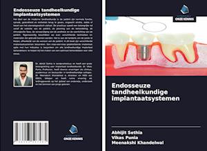 Endosseuze tandheelkundige implantaatsystemen