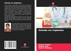 Oclusão em Implantes