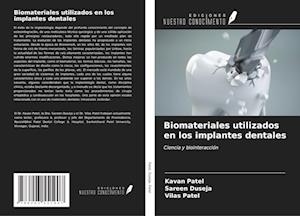 Biomateriales utilizados en los implantes dentales