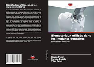 Biomatériaux utilisés dans les implants dentaires