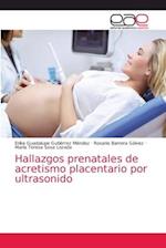Hallazgos prenatales de acretismo placentario por ultrasonido