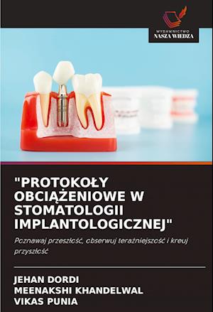 Protokoly Obci&#260;&#379;eniowe W Stomatologii Implantologicznej