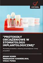 Protokoly Obci&#260;&#379;eniowe W Stomatologii Implantologicznej