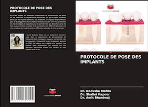 Protocole de Pose Des Implants